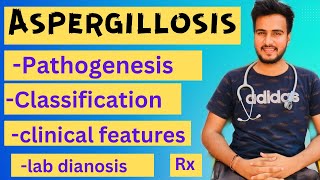 Aspergillosis microbiologymorphologypathogenesislabdiagnosisTreatment [upl. by Jaco924]