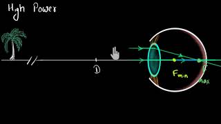 Myopia amp Hypermetropia Hindi  Human eye and the colourful world  Physics  Khan Academy [upl. by Shimkus730]