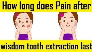 How long does pain after wisdom tooth extraction last [upl. by Secrest757]