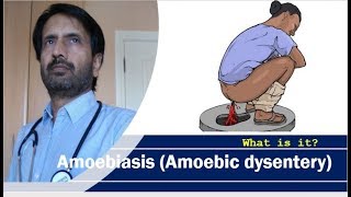 Amoebiasis Amoebic dysentery  Treatment complications and prevention of dysentery [upl. by Asirahc]