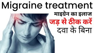 Migraine ka ilaj  Migraine treatment at home in Hindi [upl. by Grover]