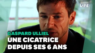 Gaspard Ulliel et sa cicatrice lhistoire derrière cette marque qui faisait quotpartie de luiquot [upl. by Assirrac]