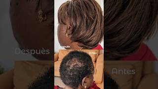 😱Como poner EXTENSIONES Cocidas en AFRO CORTO y con ALOCIA [upl. by Gariepy]