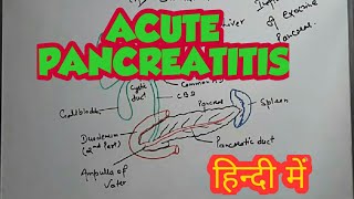 Pathology of Acute pancreatitis in hindi [upl. by Des764]