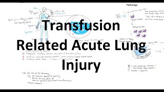 Transfusion Related Acute Lung Injury  TRALI [upl. by Eicaj91]