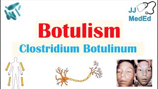 Botulism Clostridium Botulinum Pathogenesis Symptoms Diagnosis Treatment Prevention [upl. by Yrroc]