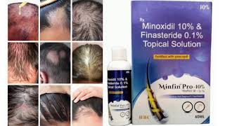 Minfin Pro 10 Topical Solution Minoxidil 10 amp Finasteride 01 Topical Solution [upl. by Andre328]