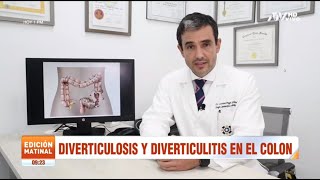 ⚠️ El 𝗠𝗲𝗷𝗼𝗿 𝗧𝗥𝗔𝗧𝗔𝗠𝗜𝗘𝗡𝗧𝗢 de la Enfermedad Diverticular Actualizado Para pacientes [upl. by Torres719]