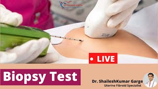 Live Biopsy Test  How Biopsy Test is Done  biopsy test kaise hota hai [upl. by Elkraps]