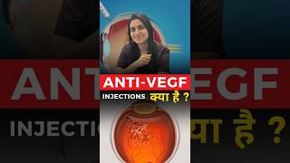 Anti  VEGF Injections क्या है [upl. by Yrrot]