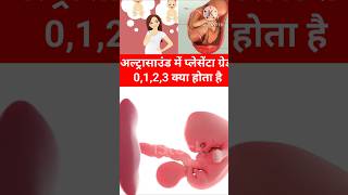 Pregnancy Ultrasound me Placenta Grade 0123 kya hota hai shorts pregnancy placenta pregnant [upl. by Farhi]