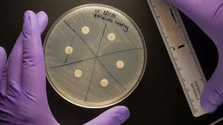 ID Laboratory Videos Antibiotic susceptibility testing [upl. by Jammal849]