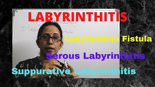 055 Labyrinthitis otitismedia vertigo [upl. by Bourn]