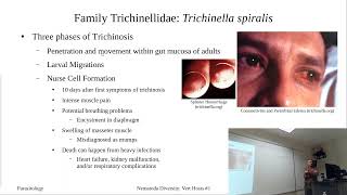 Trichinella spiralis [upl. by Beach]