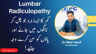 What is Lumbar Radiculopathy  Sciatica Pain  Kamar Ki Ase Dard Jo Paon Tak Jye  Nerve Compression [upl. by Duax]