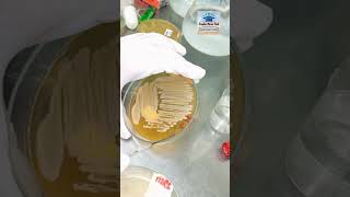 Bacterial culture plate shorts laboratory [upl. by Lem]