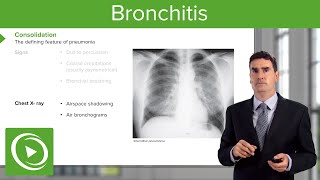 Bronchitis Consequences Symptoms amp Treatment – Respiratory Medicine  Lecturio [upl. by Tupler393]