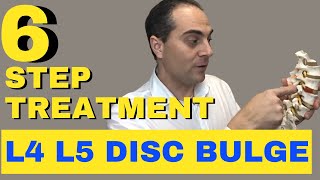 6 Step L4 L5 Disc Bulge Treatment L4 L5 Bulging Disc Treatment by Dr Walter Salubro [upl. by Martreb]