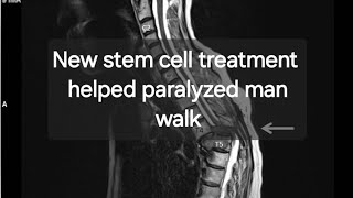 New stem cell treatment helped paralyzed man walk again [upl. by Ajuna]