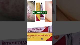 BETNOVATEC Cream use amp side effects squalane shortsfeed shorts beautycream facecreamfungal [upl. by Eanil]