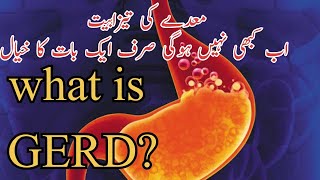 Acid reflux treatment and home remedy to stop symptomshealthology by Dr junaid [upl. by Giarg]