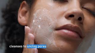 Clear Acne and Prevent New Breakouts │ CeraVe Skincare [upl. by Carlye]