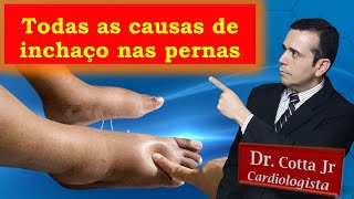 O que pode ser Inchaço nos Pés e nas Pernas Vídeo definitivo sobre todas as causas e como resolver [upl. by Anpas]