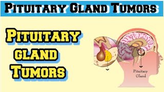 pituitary adenoma pathology [upl. by Haldis]