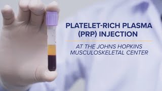 PlateletRich Plasma PRP Injections  QampA [upl. by Auliffe]