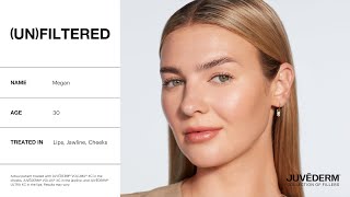 Why Megan Was an Instant JUVÉDERM® Fan  Unfiltered With JUVÉDERM® [upl. by Ydissahc]