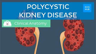 Polycystic kidney disease pathology symptoms diagnosis and treatment  Kenhub [upl. by Hannala730]