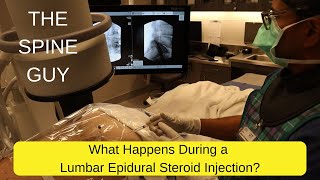 What Happens During a Lumbar Epidural Steroid Injection [upl. by Ethelyn]