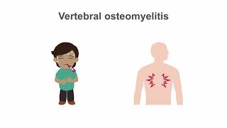 How to treat osteomyelitis [upl. by Hike598]