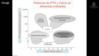 Hiperparatiroidismo primario [upl. by Perzan]