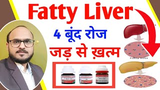 Fatty Liver Treatment Medicine  Chelidonium Majus for Liver  Fatty Liver Homeopathic Medicine [upl. by Jegger]