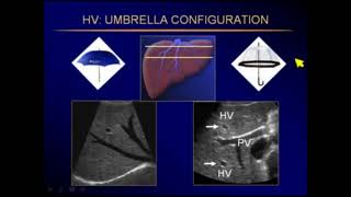 Ultrasound Abdominal pathology [upl. by Aer]