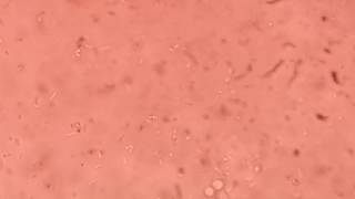 Listeria monocytogenes tumbling motility under microscope [upl. by Odille]