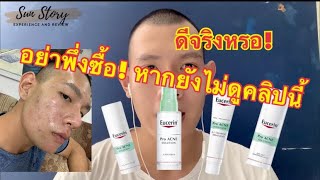 รีวิว Set ucerin Pro Acne จะเลือกตัวไหนดี [upl. by Kane585]