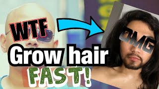 MY 70DAY MINOXIDIL HAIR REGROWTH JOURNEY minoxidil [upl. by Arianne]