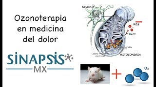 Ozonoterapia en medicina del dolor [upl. by Dickson]