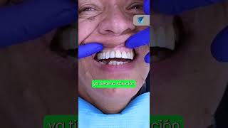 🦷 Pasa de Prótesis a Implantes Dentales El Cambio Definitivo ✨ implantesdentales shorts dentist [upl. by Cohl]