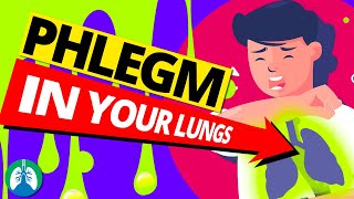 Top 10 Ways to Get Rid of Constant Mucus and Phlegm in Your Throat [upl. by Steffie821]