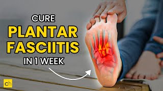 How To Cure Plantar Fasciitis in One Week  Credihealth plantarfasciitis exercise footpain [upl. by Tess]