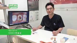 SPIDENT 사용자 인터뷰 User Interview  EsCem RMGI 국문Korean [upl. by Anehsat]