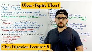 Ulcer Disease peptic ulcer  Causes symptoms and Treatments [upl. by Braden396]