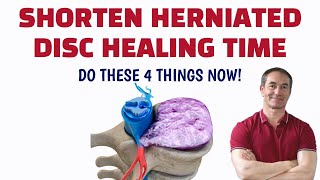 Shorten Your Herniated Disc Recovery Time [upl. by Silrac]