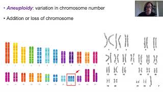 Chromosome abnormalities [upl. by Sanders514]