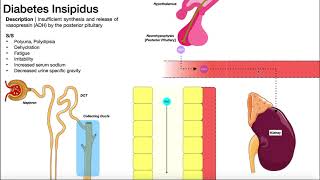 Diabetes Insipidus  Mechanism amp SignsSymptoms [upl. by Ettelracs]