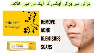 Biocos Acne Cream  Anti Acne Cream  Remove blemishes  Scars in First Application [upl. by Trellas802]