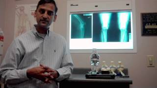 Ask the Expert Knee Pain [upl. by Robi163]